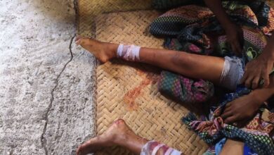 A victim injured in the airstrike on Chinhnit, in Magway Region’s Mindon Township, on October 8 (Photo: Thayet District PDF Battalion 4)